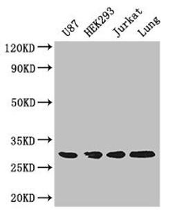 Western Blot. Positive WB detected in: U87 whole cell lysate, HEK293 whole cell lysate, Jurkat whole cell lysate, Mouse lung tissue. All lanes: LASP1 antibody at 4ug/ml. Secondary. Goat polyclonal to rabbit IgG at 1/50000 dilution. Predicted band size: 30, 37, 24 kDa. Observed band size: 30 kDa.
