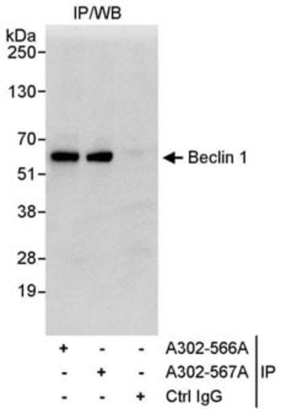 Detection of human Beclin 1 by western blot of immunoprecipitates.