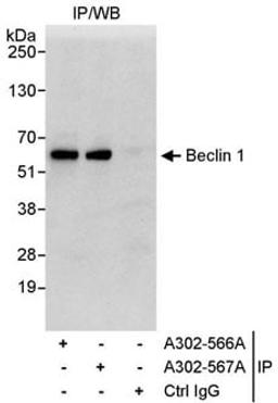 Detection of human Beclin 1 by western blot of immunoprecipitates.