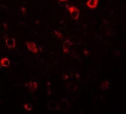 Immunofluorescence: MHC Class II Antibody [NBP1-76296] - Human brain tissue with CIITA antibody.