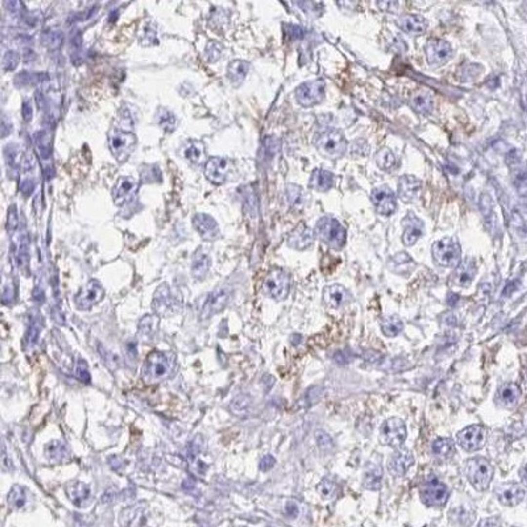 Immunohistochemistry: SHISA8 Antibody [NBP2-32436] - testis cancer