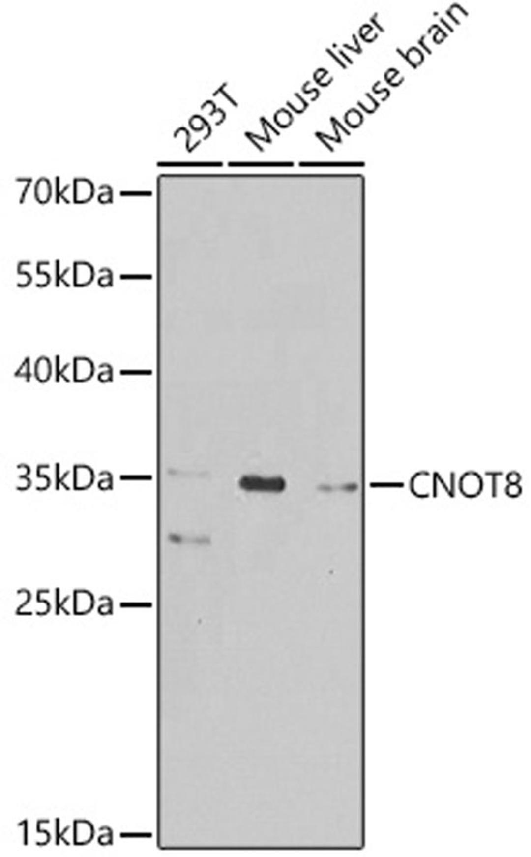 Western blot - CNOT8 antibody (A8058)