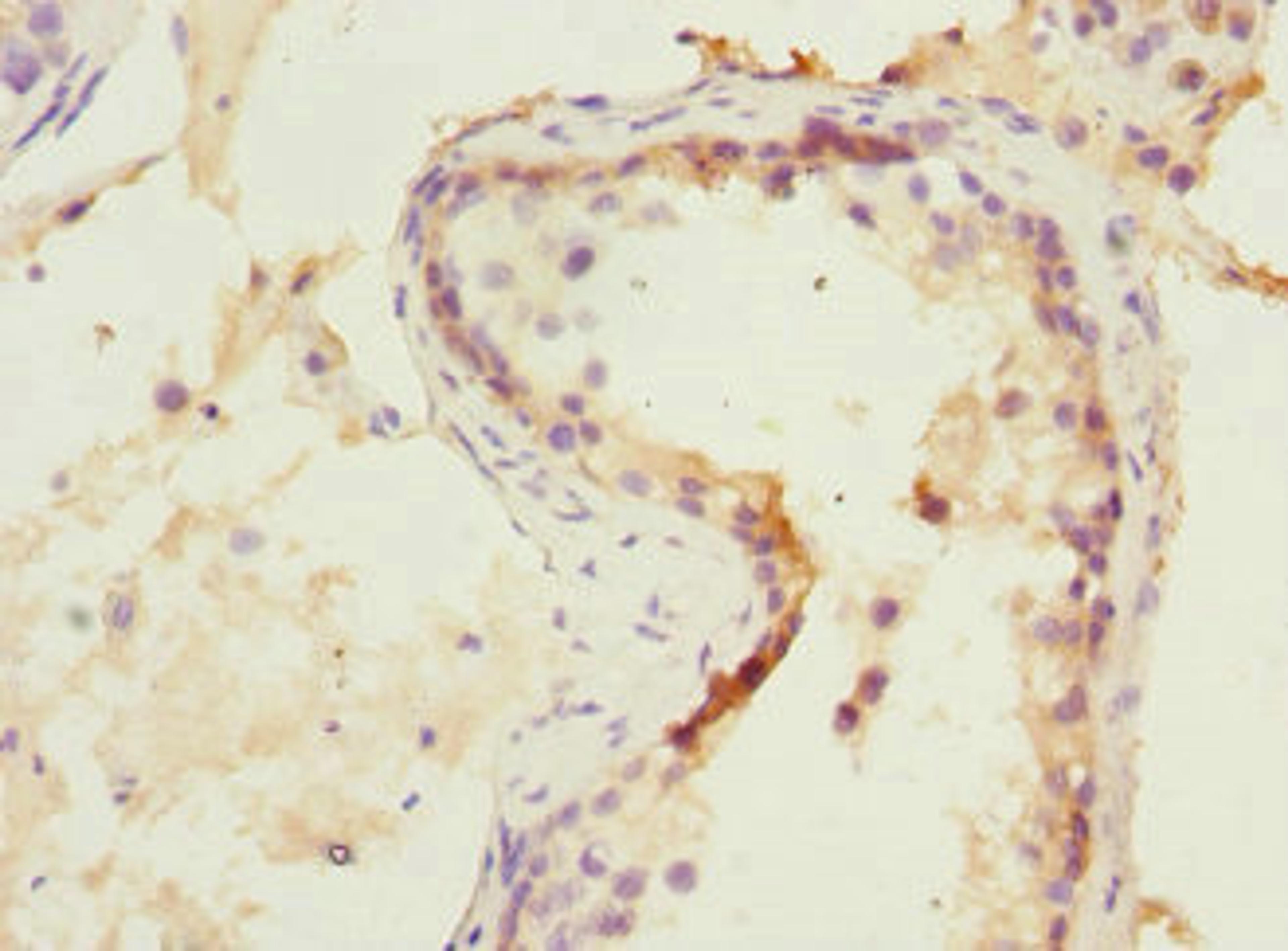 Immunohistochemistry of paraffin-embedded human testis tissue using CSB-PA015901DSR1HU at dilution of 1:100