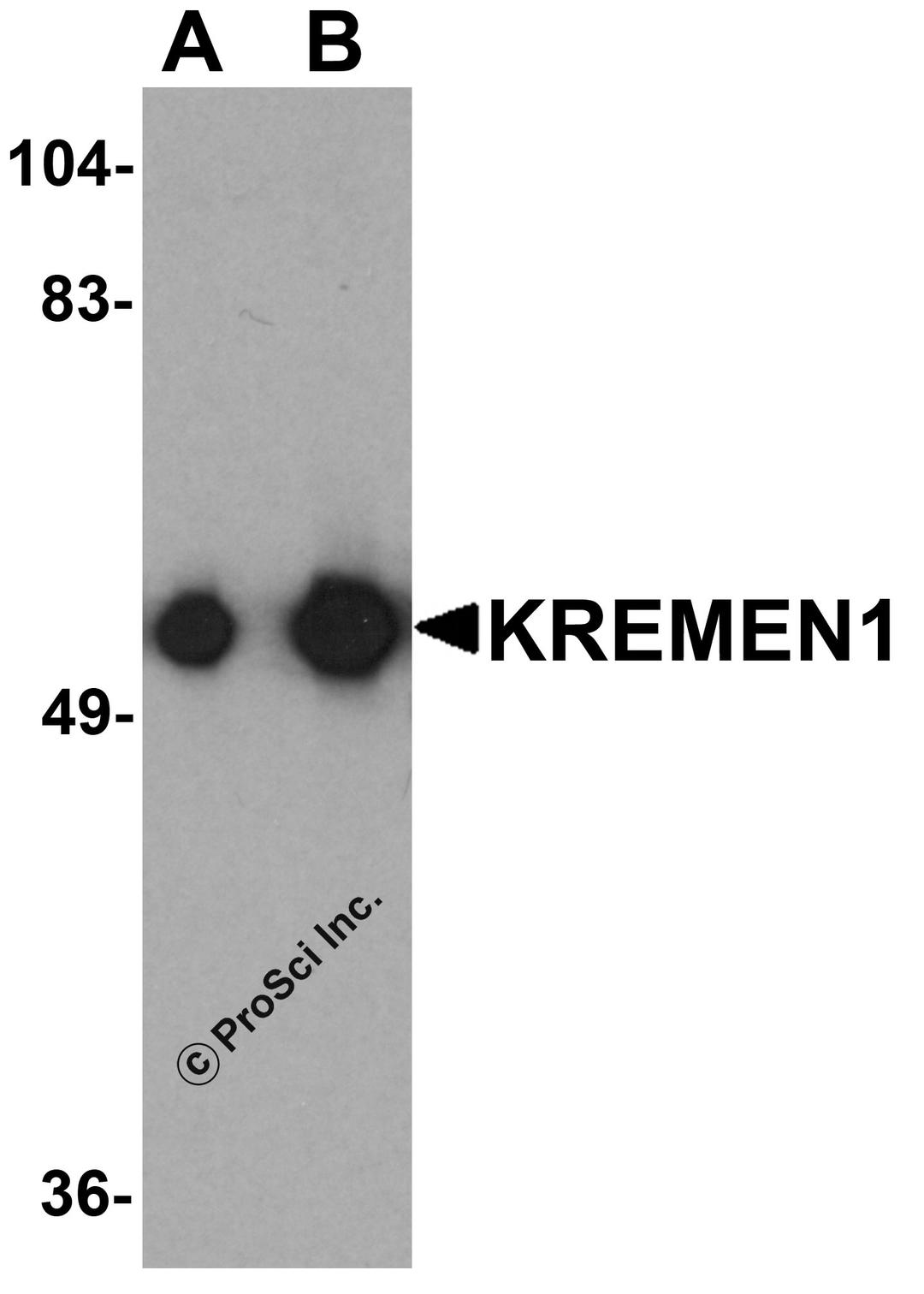 Western blot analysis of KREMEN1 in rat small intestine tissue lysate with KREMEN1 antibody at (A) 0.125 and (B) 0.25 μg/mL