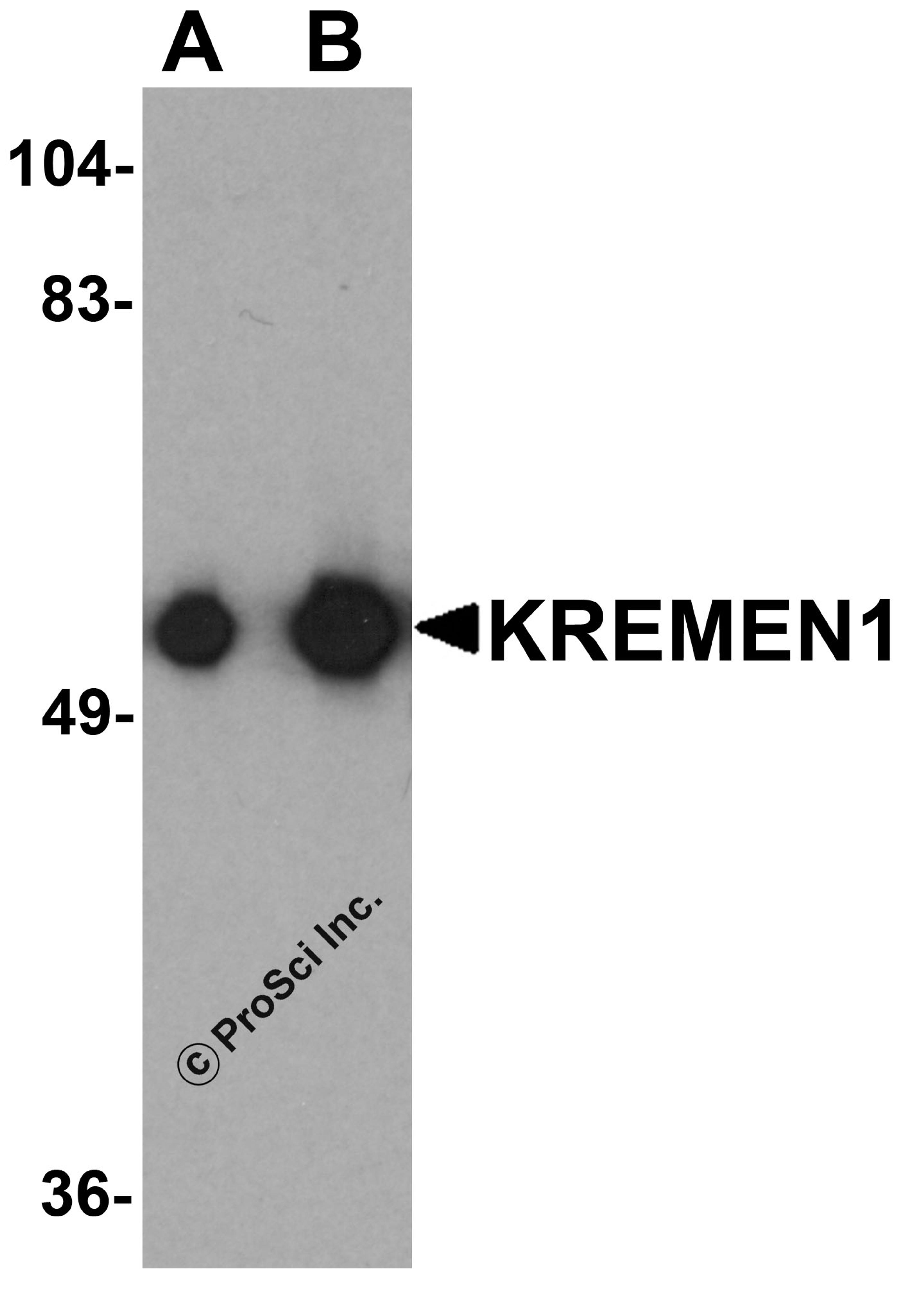 Western blot analysis of KREMEN1 in rat small intestine tissue lysate with KREMEN1 antibody at (A) 0.125 and (B) 0.25 μg/mL