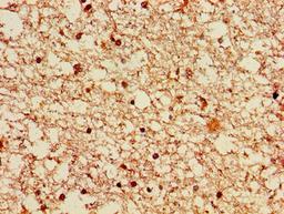 Immunohistochemistry of paraffin-embedded human brain tissue using CSB-PA722493LA01HU at dilution of 1:100