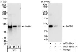 Detection of human SATB2 by western blot and immunoprecipitation.