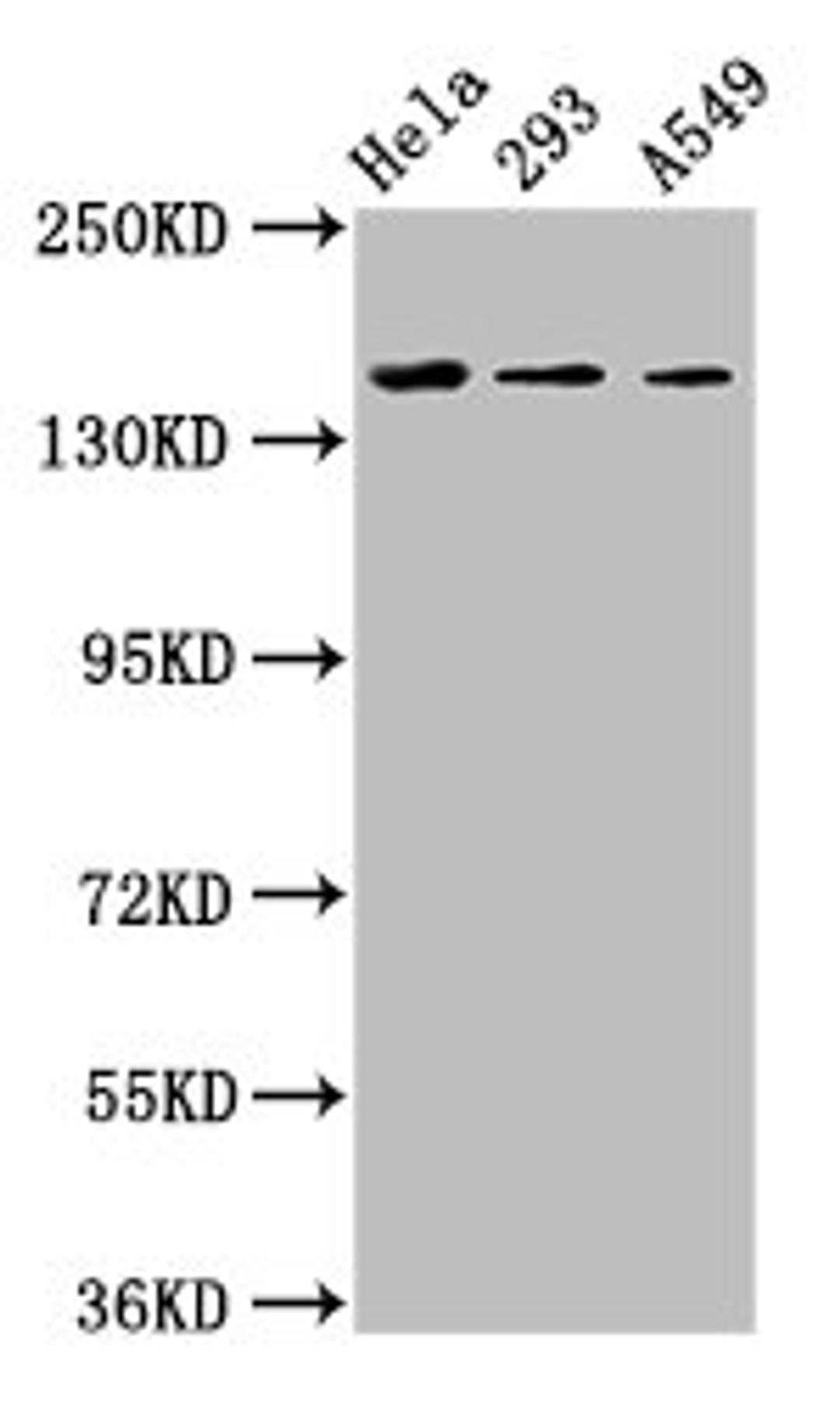 Western Blot. Positive WB detected in: Hela whole cell lysate, 293 whole cell lysate, A549 whole cell lysate. All lanes: CDON antibody at 3.4ug/ml. Secondary. Goat polyclonal to rabbit IgG at 1/50000 dilution. Predicted band size: 140, 137 kDa. Observed band size: 140 kDa. 