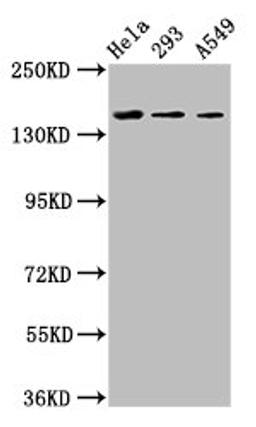 Western Blot. Positive WB detected in: Hela whole cell lysate, 293 whole cell lysate, A549 whole cell lysate. All lanes: CDON antibody at 3.4ug/ml. Secondary. Goat polyclonal to rabbit IgG at 1/50000 dilution. Predicted band size: 140, 137 kDa. Observed band size: 140 kDa. 