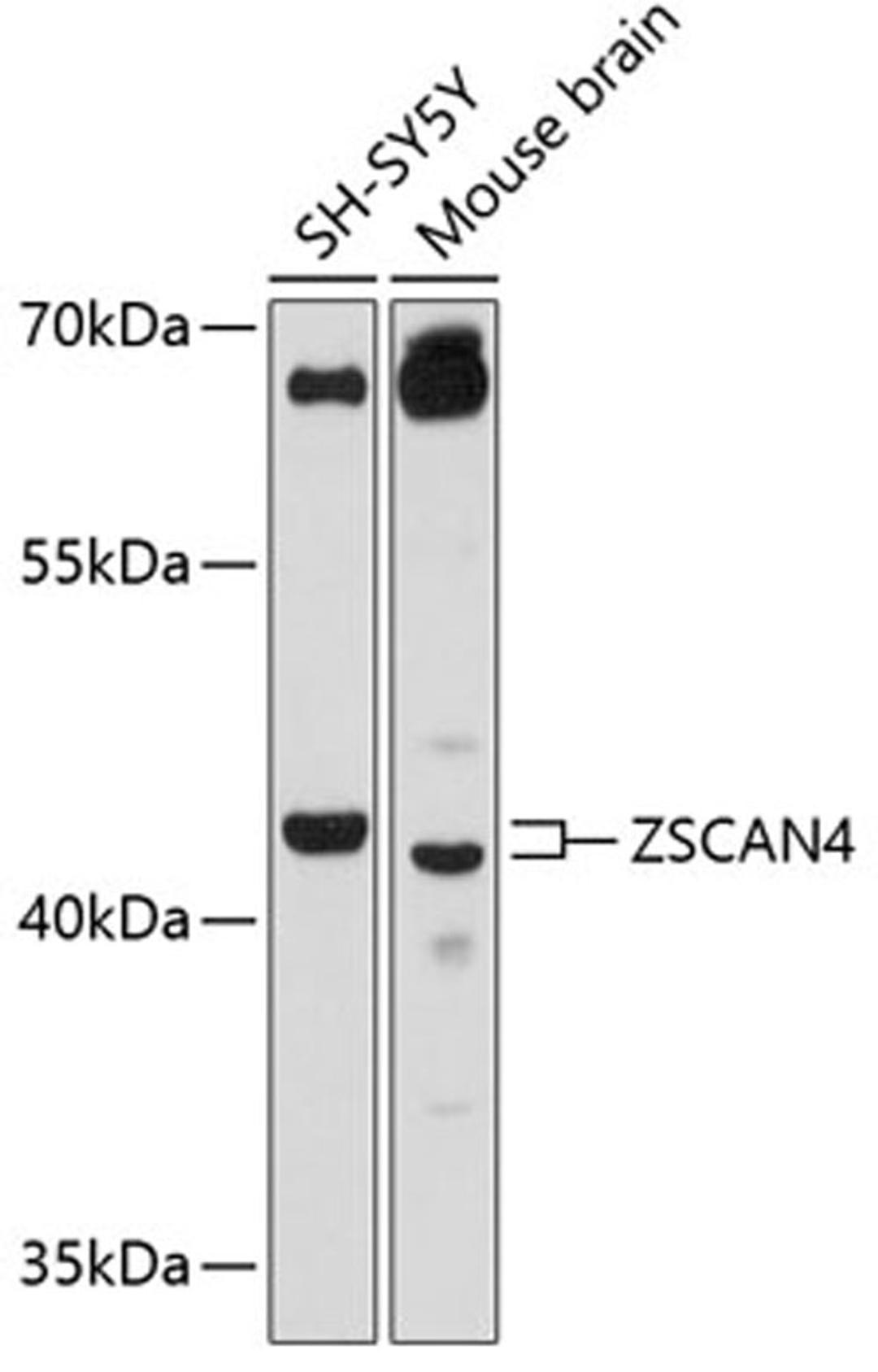 Western blot - ZSCAN4 antibody (A12015)