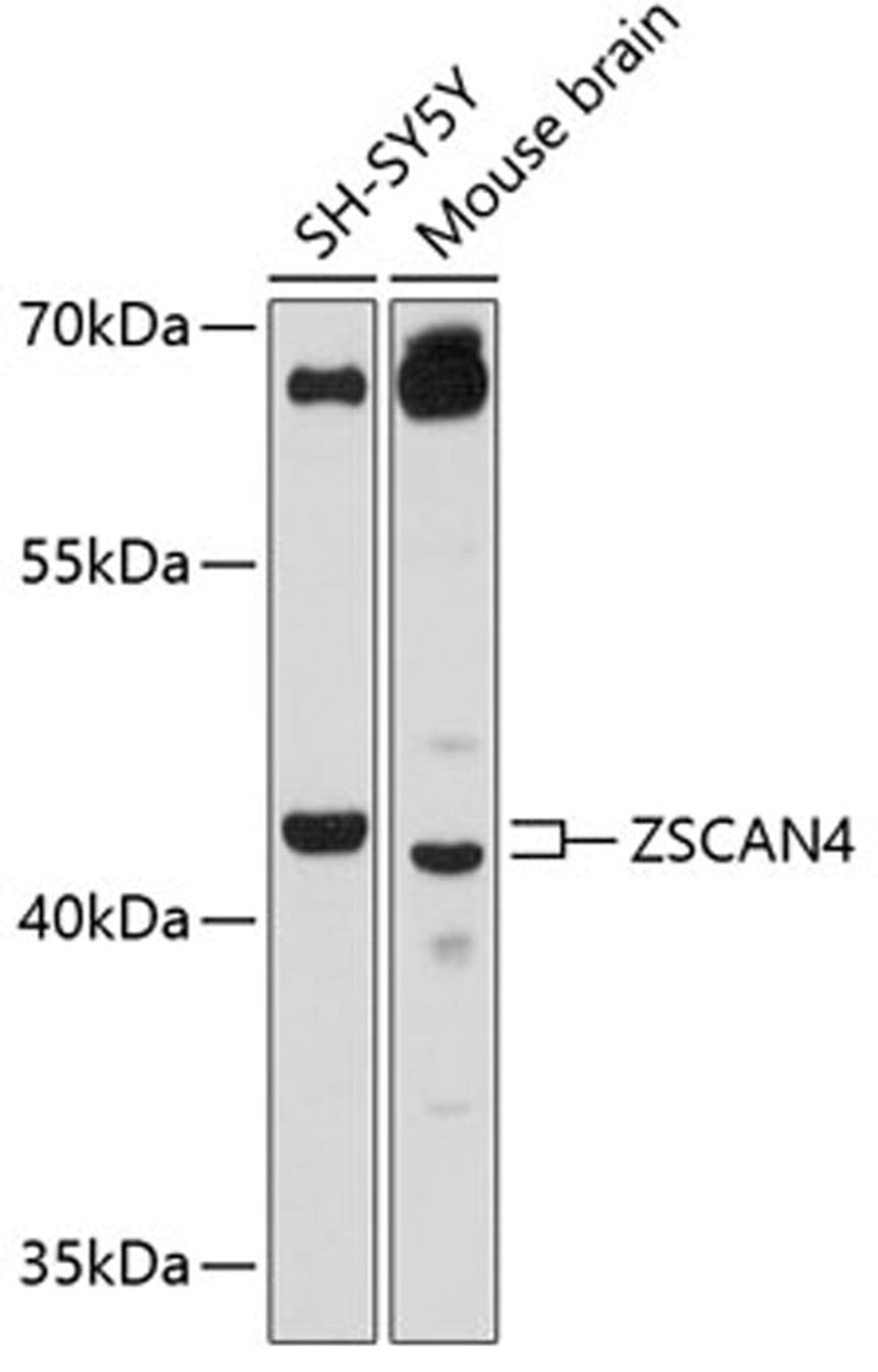 Western blot - ZSCAN4 antibody (A12015)