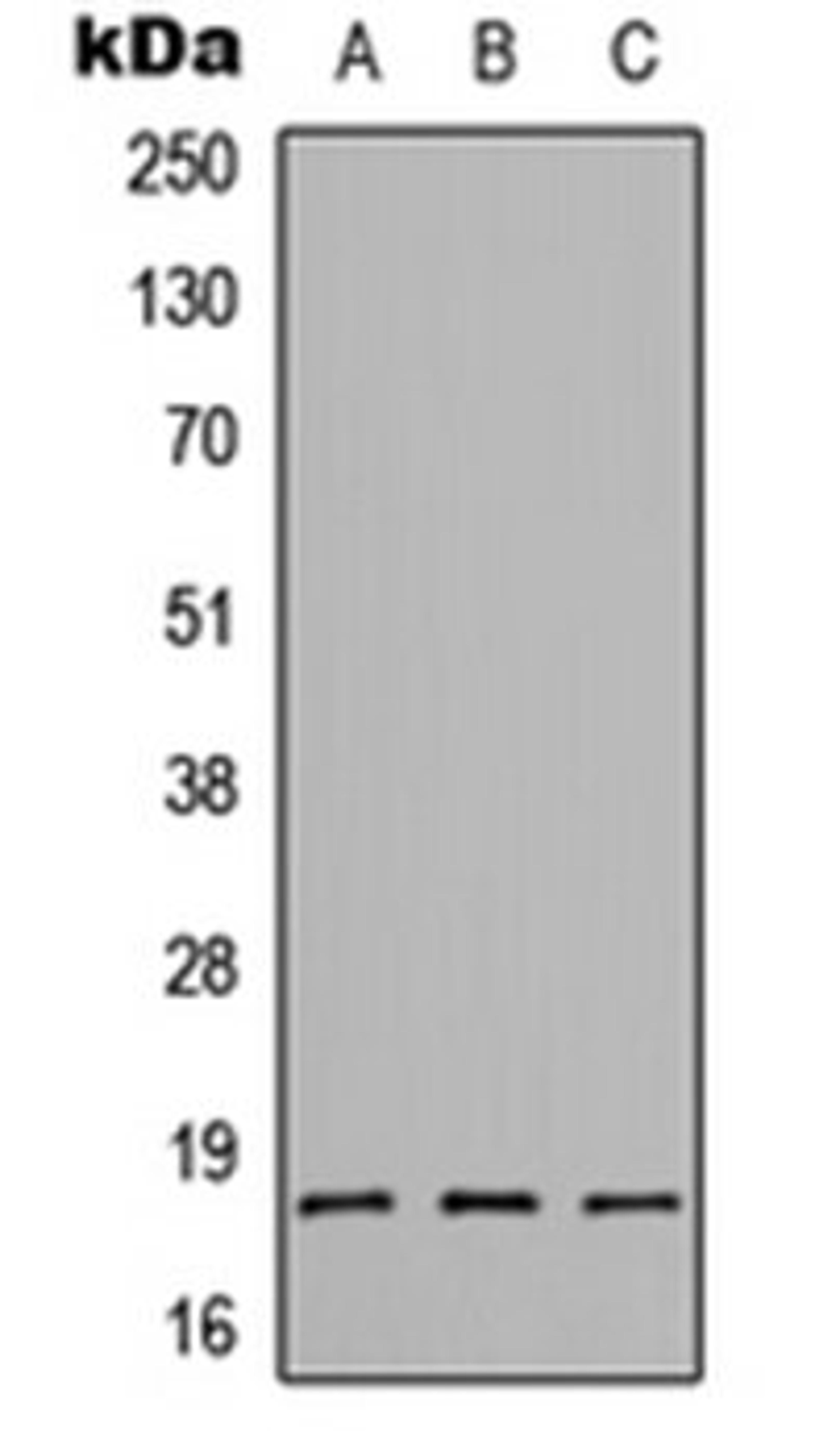 Western blot analysis of HEK293T (Lane 1), Raw264.7 (Lane 2), H9C2 (Lane 3) whole cell lysates using CMTM1 antibody