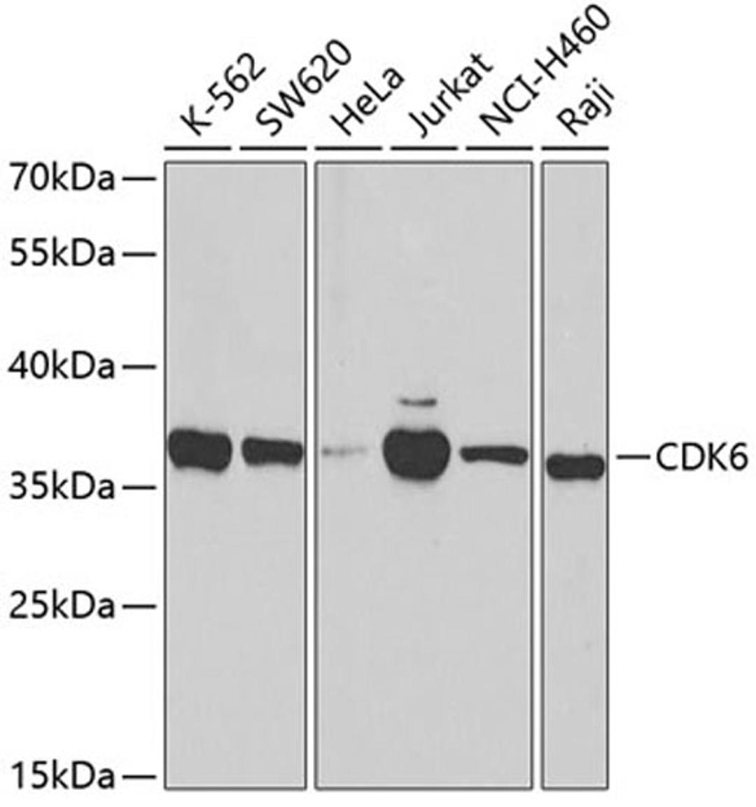Western blot - CDK6 antibody (A3165)