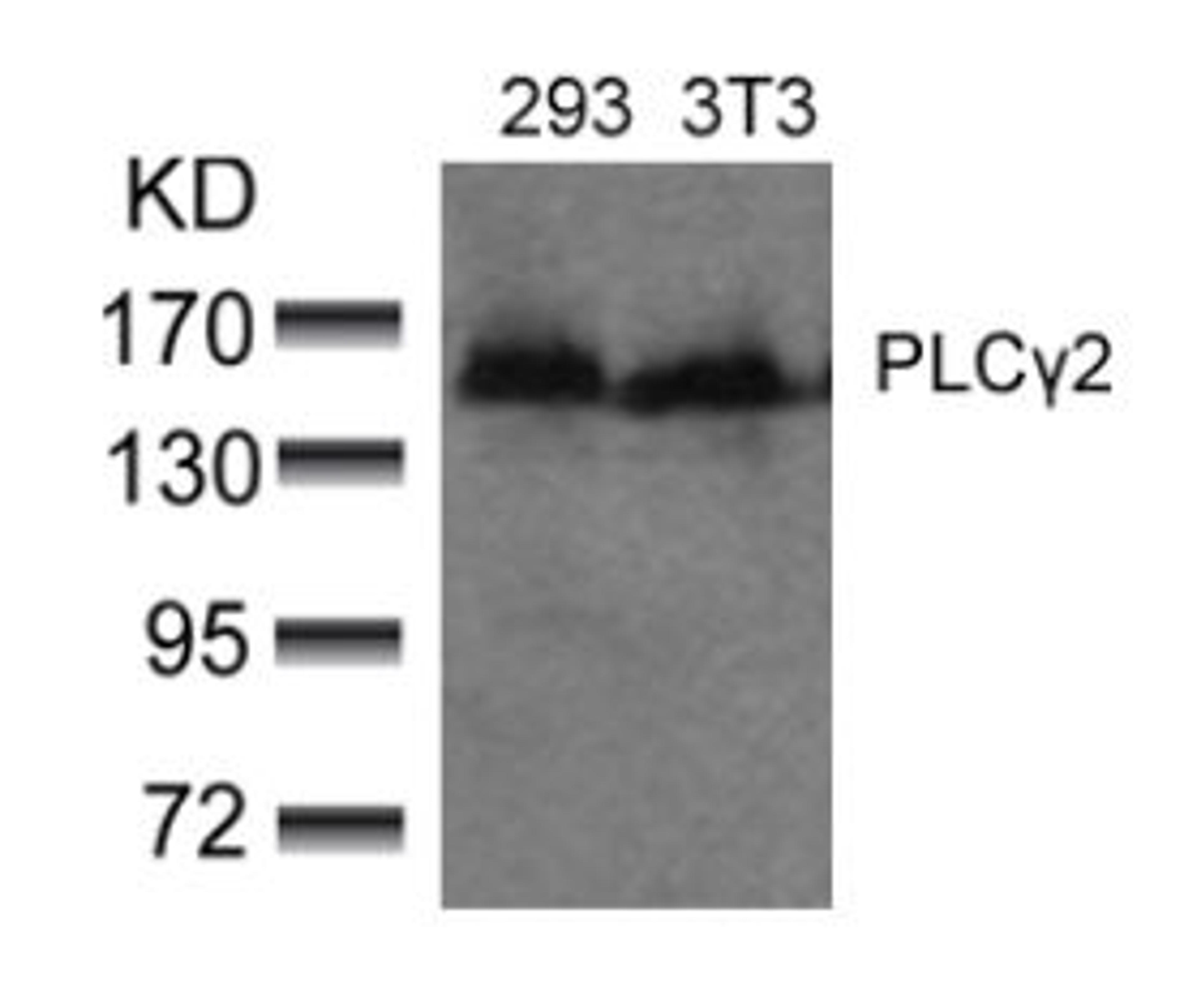Western blot analysis of lysed extracts from 293 and 3T3 cells using PLCγ2 (Ab-753).