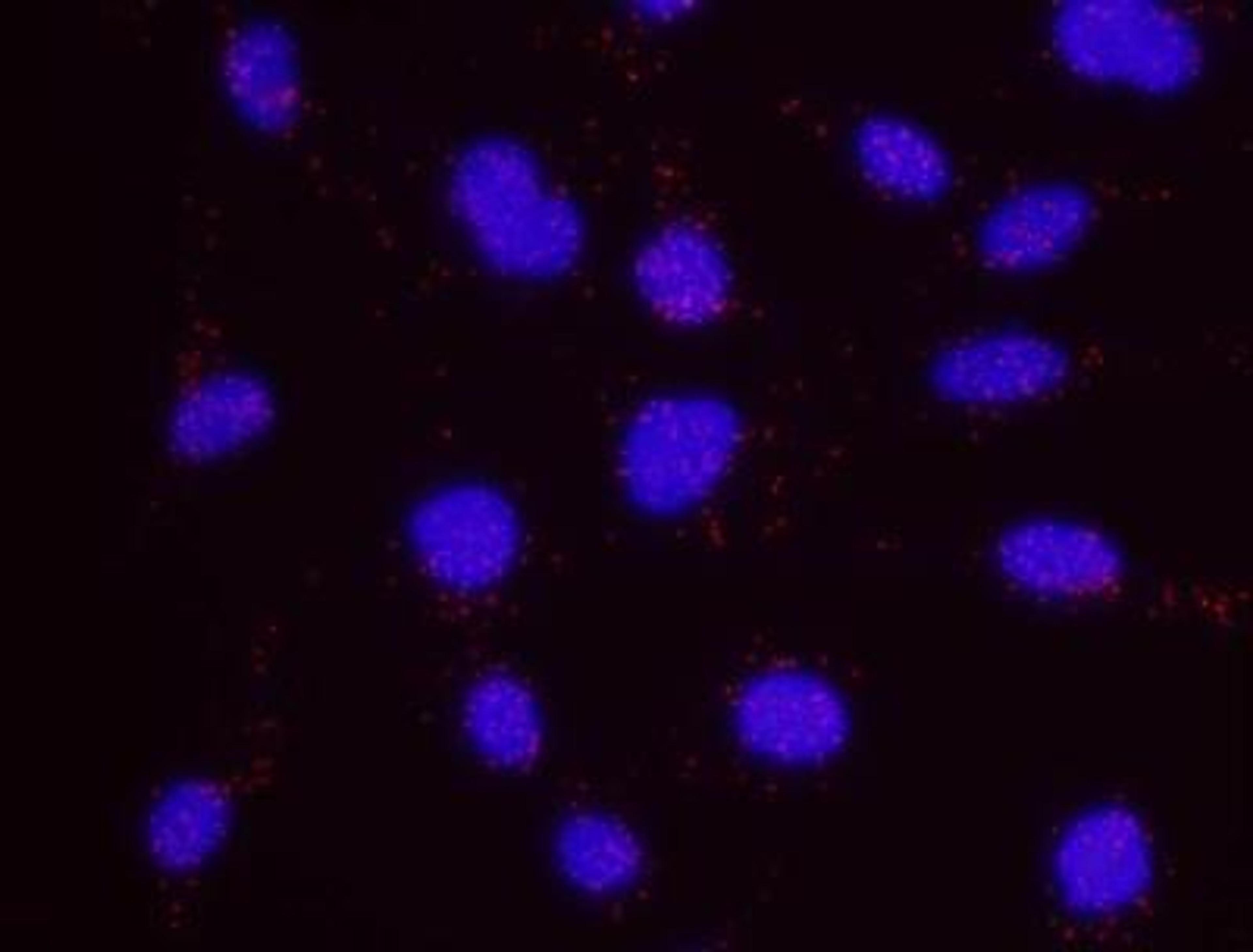 Proximity Ligation Assay: BRD2 Antibody [NBP1-30475] - Secondary-conjugate Duolink II PLA in Hela cells. goat anti-human BRD2 (NB100-260) and rabbit anti-human BRD2 (NBP1-30475). Image merged from DAPI (2ms) and Texas Red (200ms) exposures, 40X magnification.