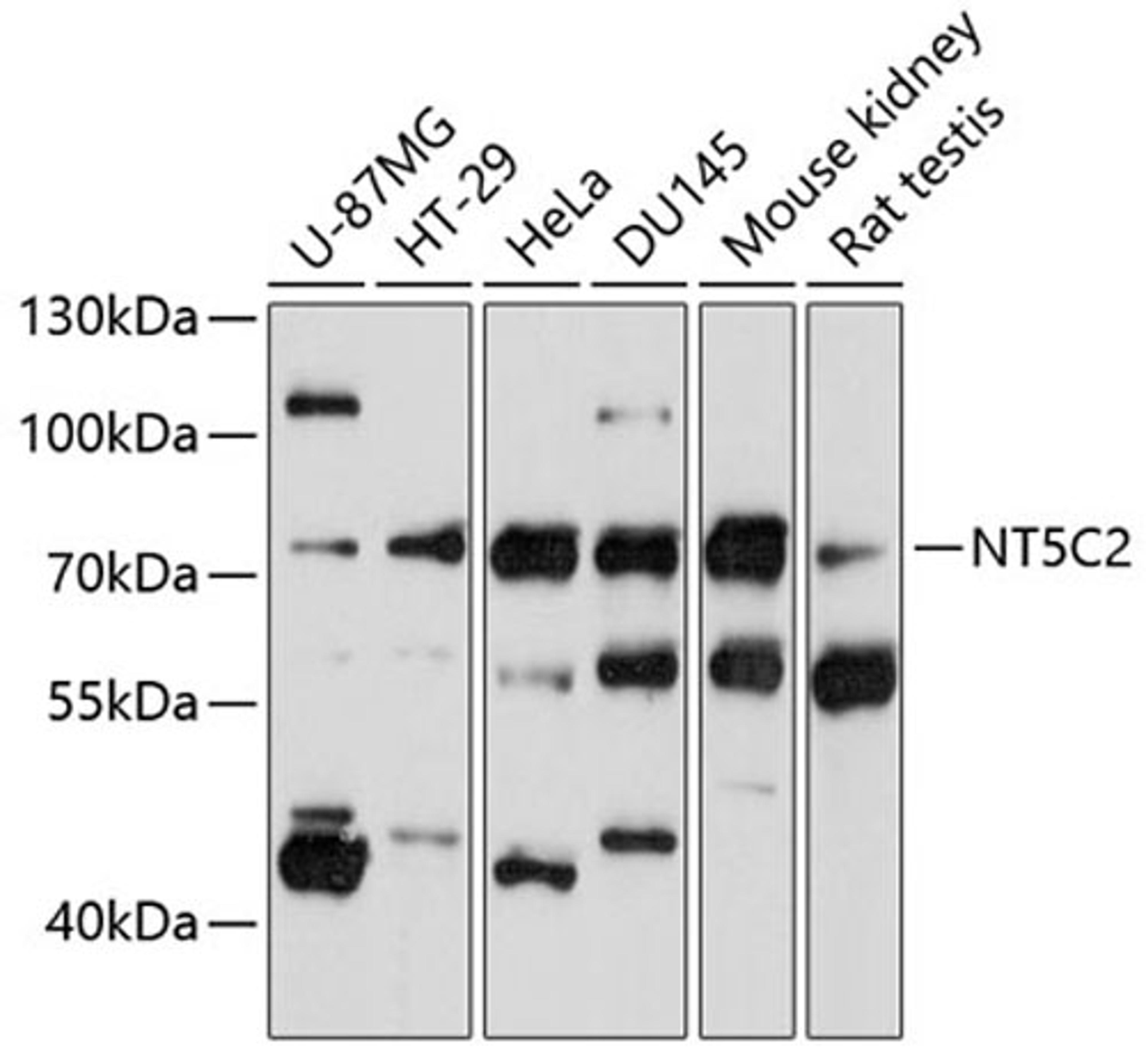 Western blot - NT5C2 antibody (A11628)