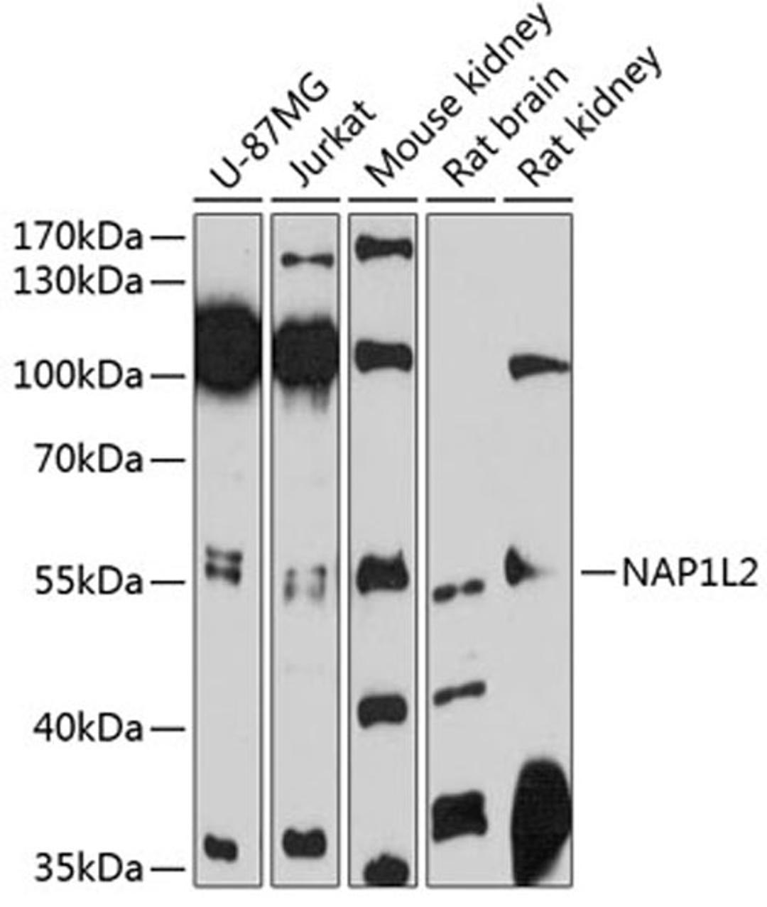 Western blot - NAP1L2 antibody (A12087)