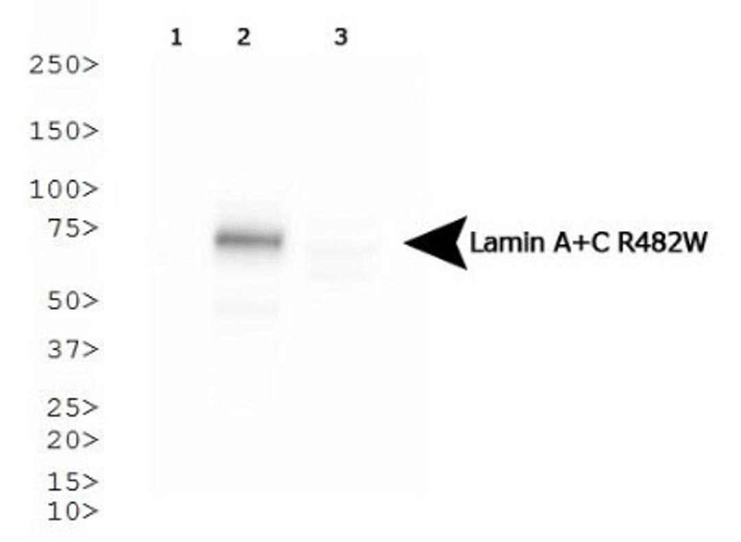 Western Blot: Lamin A + C R482W Antibody (5H8-B4) [NBP1-77402] - Analysis of Lamin A + C R482W in HeLa cells transfected with Flag-tagged Lamin A 1) wild type, 2) R482W and 3) R453W.