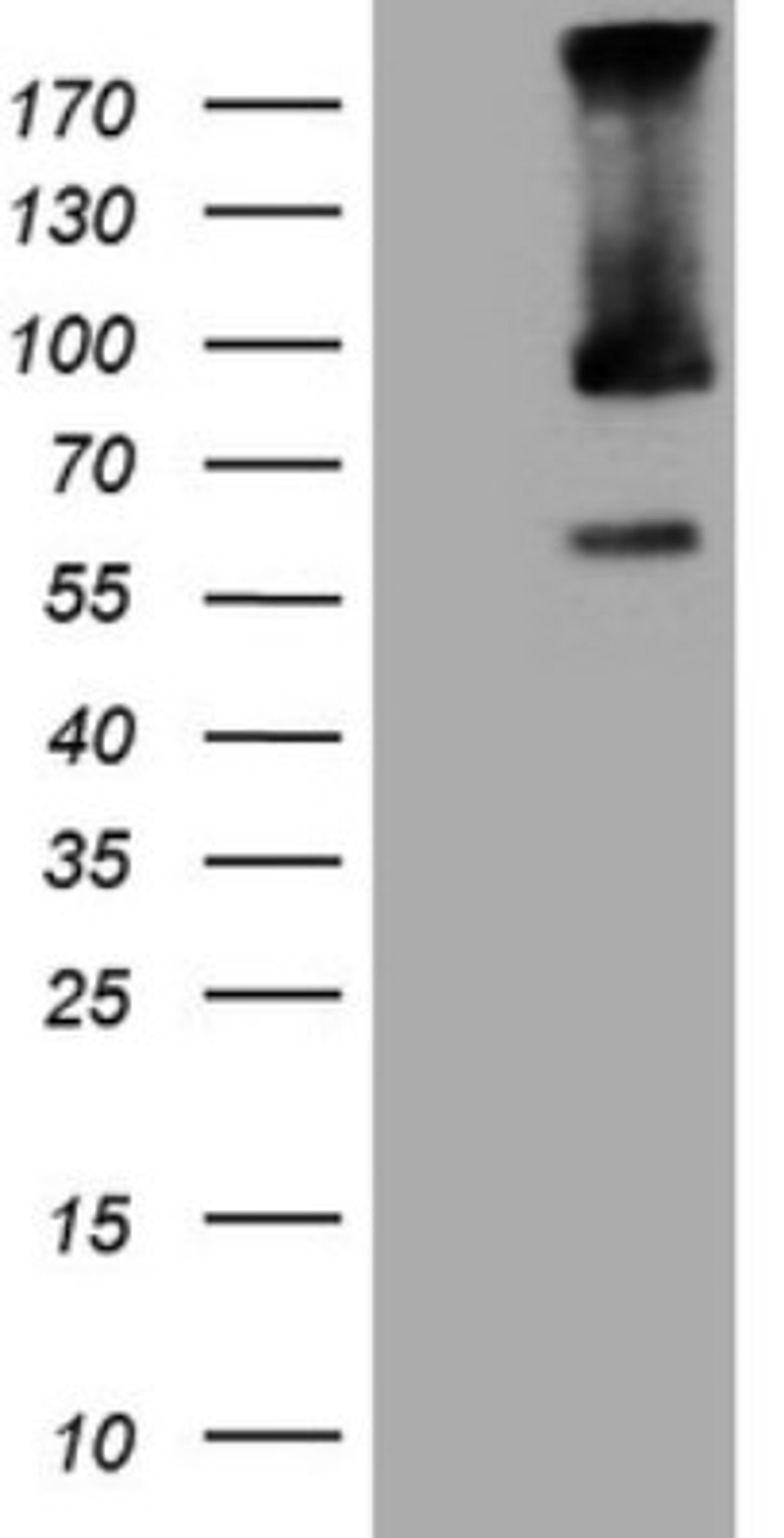 Western Blot: TRIM56 Antibody (5A1) [NBP2-46232] - Analysis of HEK293T cells were transfected with the pCMV6-ENTRY control (Left lane) or pCMV6-ENTRY TRIM56.