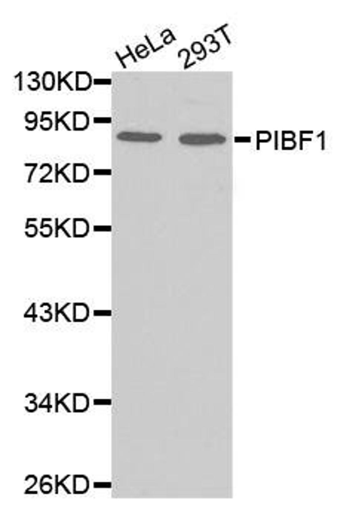 Western blot analysis of extracts of various cell lines using PIBF1 antibody