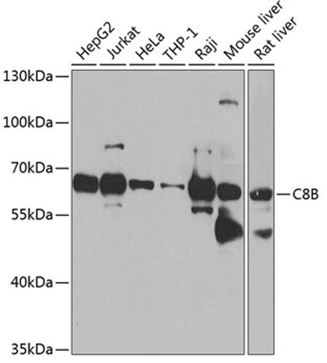 Western blot - C8B antibody (A8324)