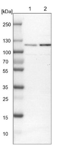 Western Blot: GCC1 Antibody [NBP1-83609] - Lane 1: NIH-3T3 cell lysate (Mouse embryonic fibroblast cells)<br/>Lane 2: NBT-II cell lysate (Rat Wistar bladder tumour cells)