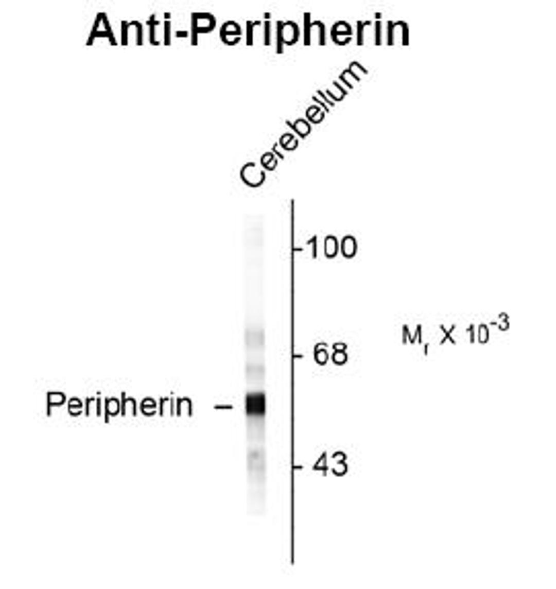 Western blot of rat cerebellar lysate showing specific immunolabeling of the ~ 57k peripherin protein.