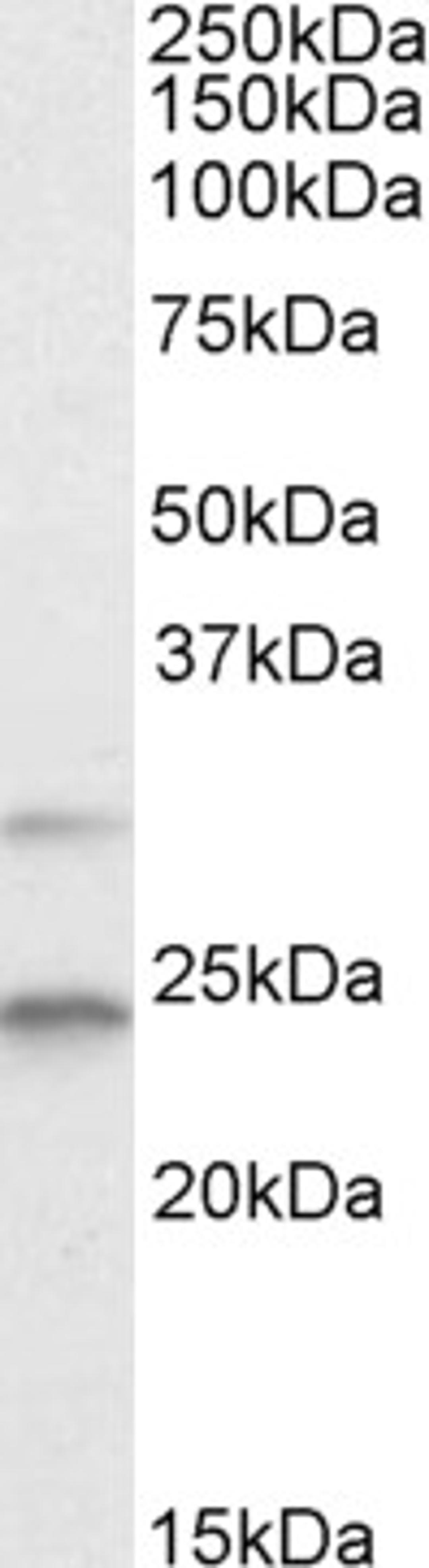 45-853 (2ug/ml) staining of HEK293 lysate (35ug protein in RIPA buffer). Primary incubation was 1 hour. Detected by chemiluminescence.