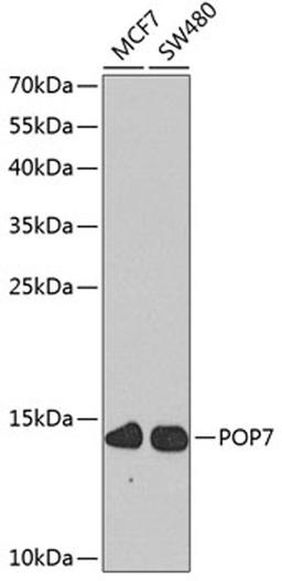 Western blot - POP7 antibody (A8183)