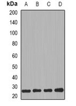 Western blot analysis of MCF7 (Lane1), HL60 (Lane2), mouse kidney (Lane3), mouse heart (Lane4) whole cell lysates using PRG2 antibody