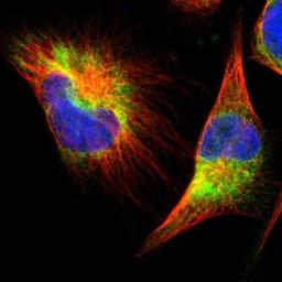 Immunocytochemistry/Immunofluorescence: FNDC3A Antibody [NBP1-88809] - Staining of human cell line U-251MG shows positivity in endoplasmic reticulum.