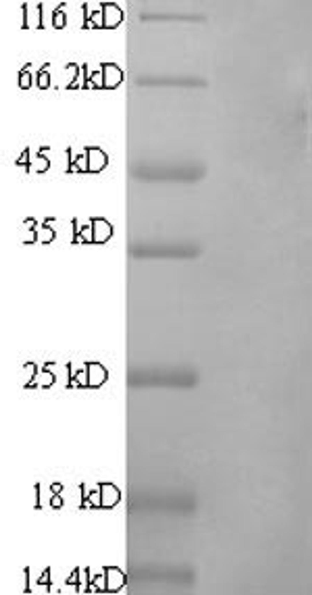 (Tris-Glycine gel) Discontinuous SDS-PAGE (reduced) with 5% enrichment gel and 15% separation gel.
