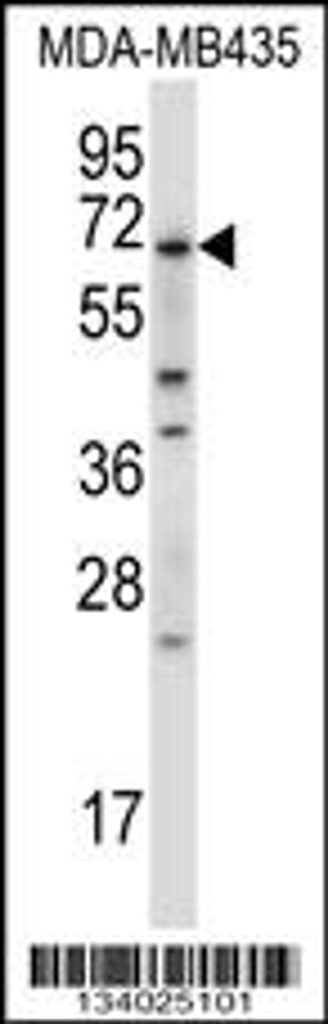 Western blot analysis in MDA-MB435 cell line lysates (35ug/lane).