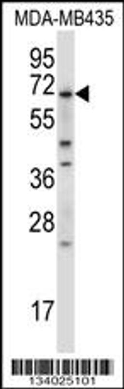 Western blot analysis in MDA-MB435 cell line lysates (35ug/lane).