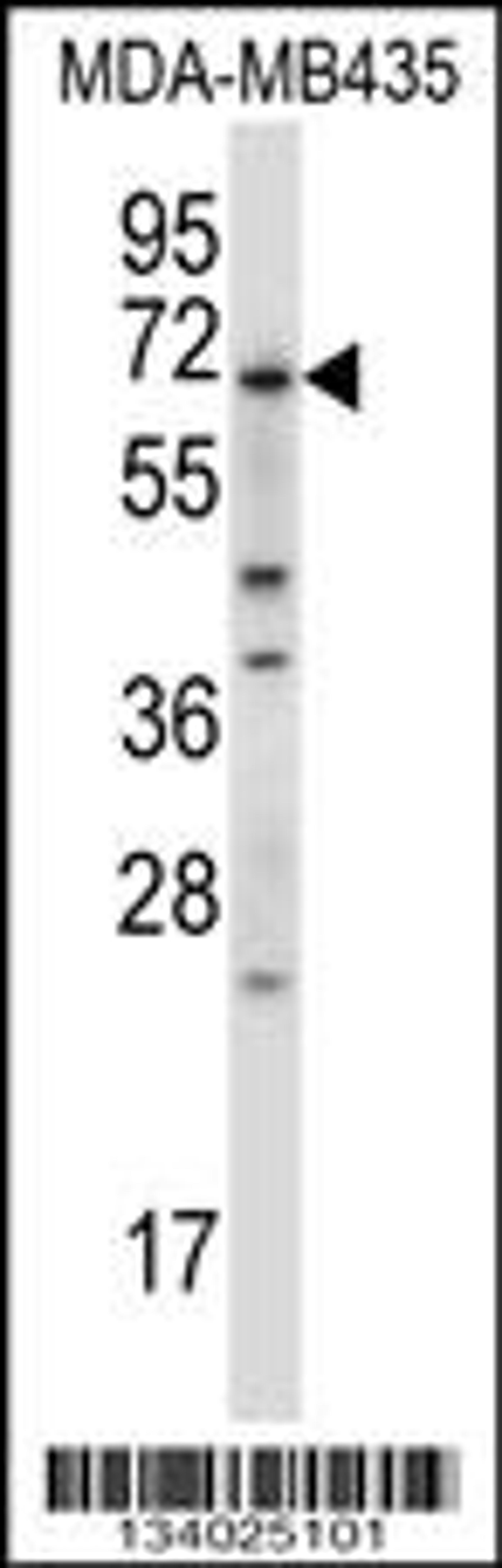 Western blot analysis in MDA-MB435 cell line lysates (35ug/lane).