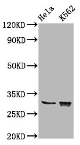 Western Blot. Positive WB detected in: Hela whole cell lysate, K562 whole cell lysate. All lanes: CHODL antibody at 6.2µg/ml. Secondary. Goat polyclonal to rabbit IgG at 1/50000 dilution. Predicted band size: 31, 26, 28, 29 kDa. Observed band size: 31 kDa