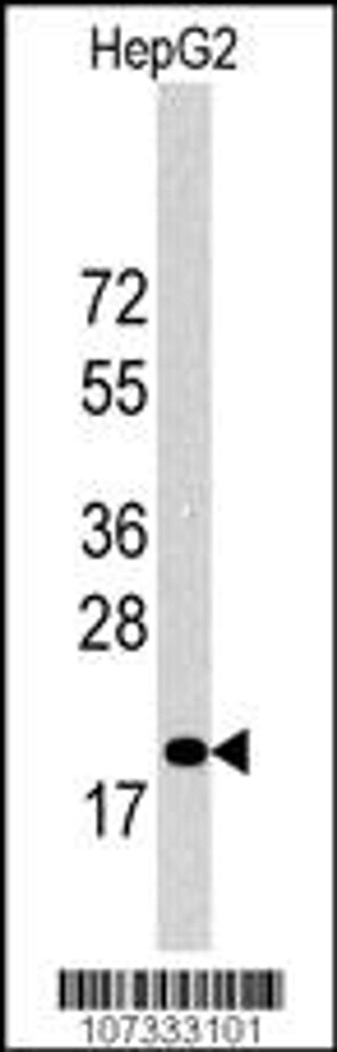 Western Blot in HepG2 cell line lysates (35ug/lane). 27Kip1(arrow) was detected using the purified Pab.