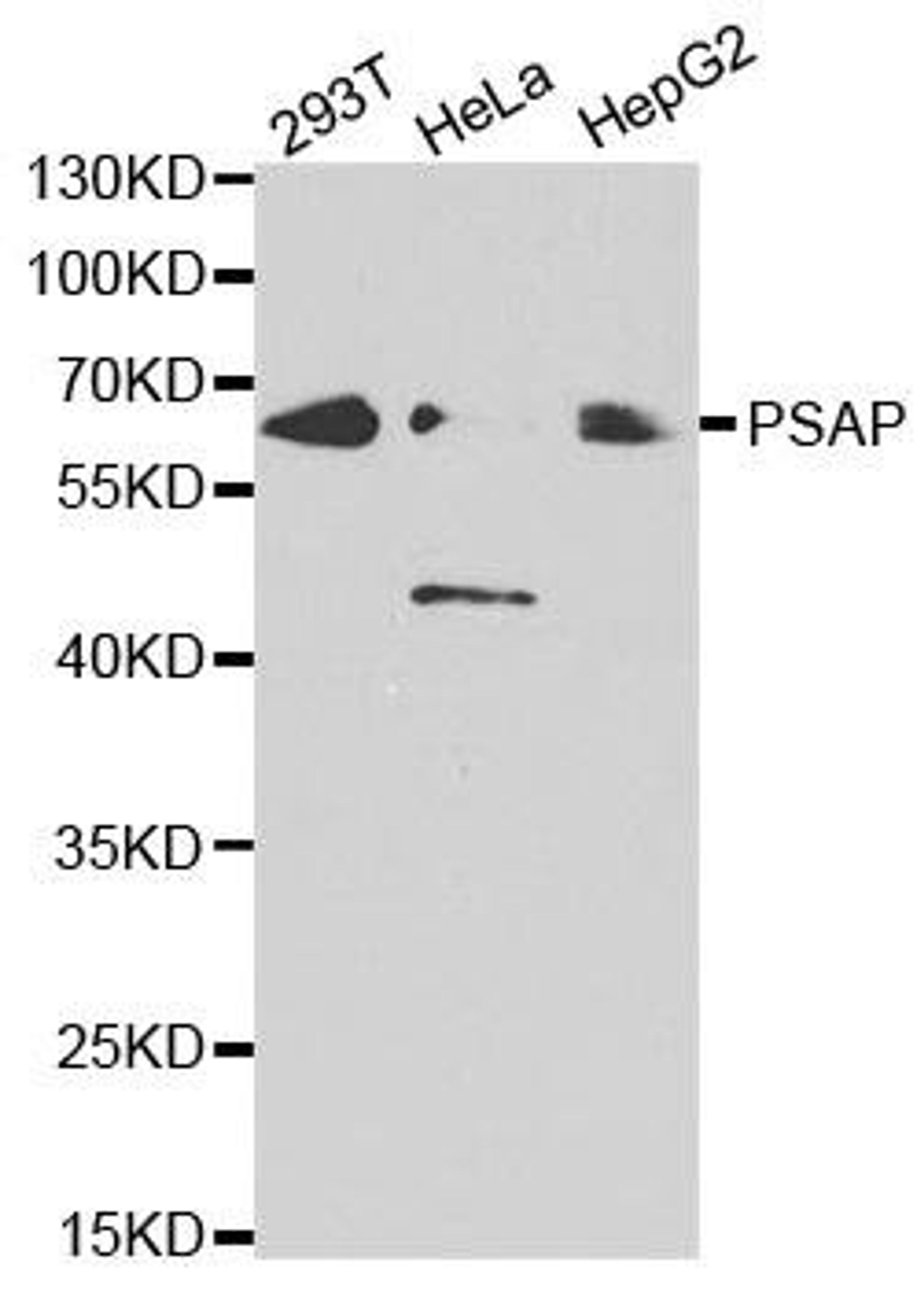 Western blot analysis of extracts of various cell lines using PSAP antibody