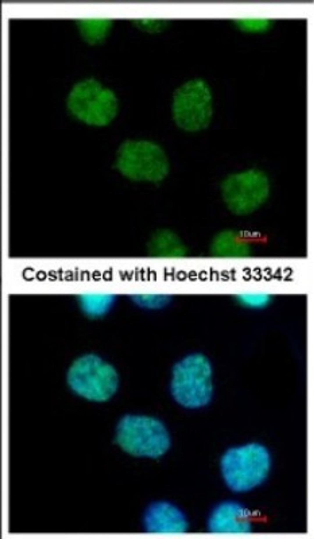 Immunocytochemistry/Immunofluorescence: MIER3 Antibody [NBP2-17290] - Immunofluorescence analysis of paraformaldehyde-fixed A431, using antibody at 1:500 dilution.