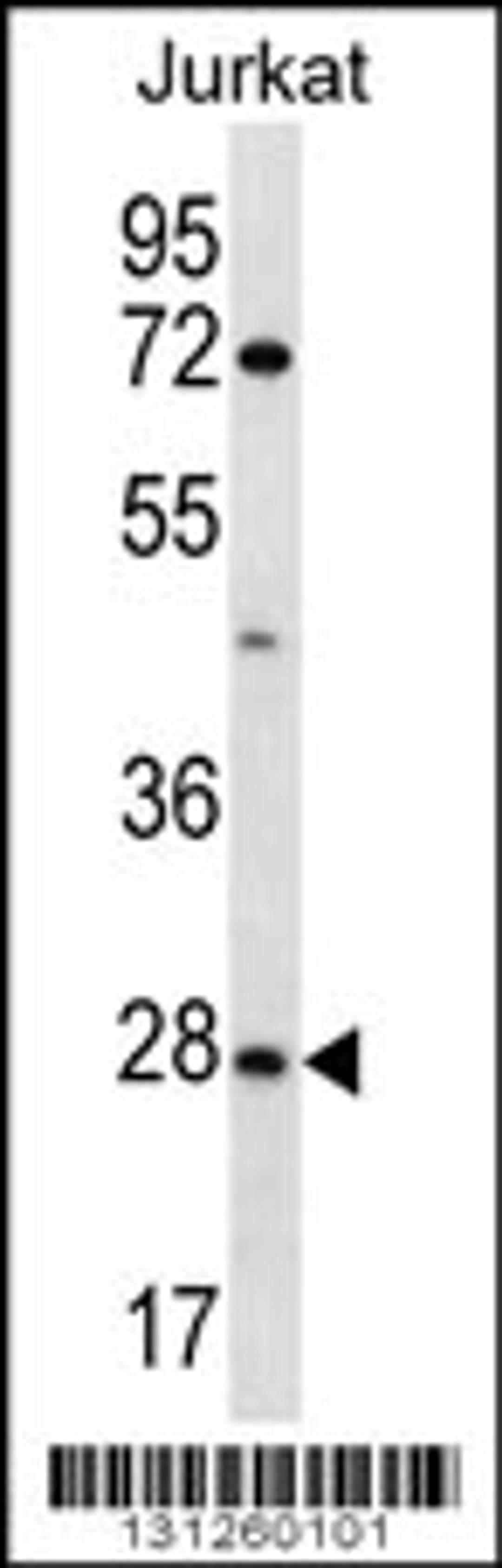 Western blot analysis in Jurkat cell line lysates (35ug/lane).