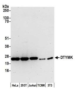 Detection of human and mouse DTYMK by WB.