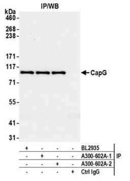 Detection of human CapG by western blot of immunoprecipitates.