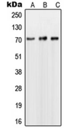 Western blot analysis of Jurkat (Lane 1), Raji (Lane 2), HepG2 (Lane 3) whole cell lysates using NUB1 antibody