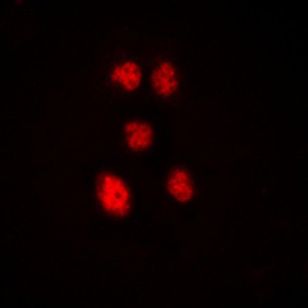 Immunofluorescense analysis of Hela cells using ZNF148 antibody