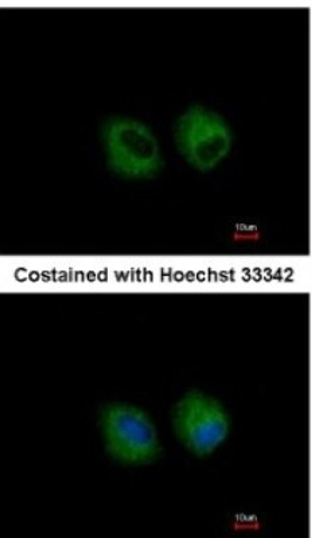 Immunocytochemistry/Immunofluorescence: IL1R2 Antibody [NBP1-32681] - Analysis of methanol-fixed A549, using antibody at 1:500 dilution.