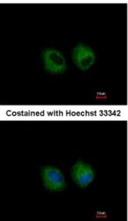 Immunocytochemistry/Immunofluorescence: IL1R2 Antibody [NBP1-32681] - Analysis of methanol-fixed A549, using antibody at 1:500 dilution.