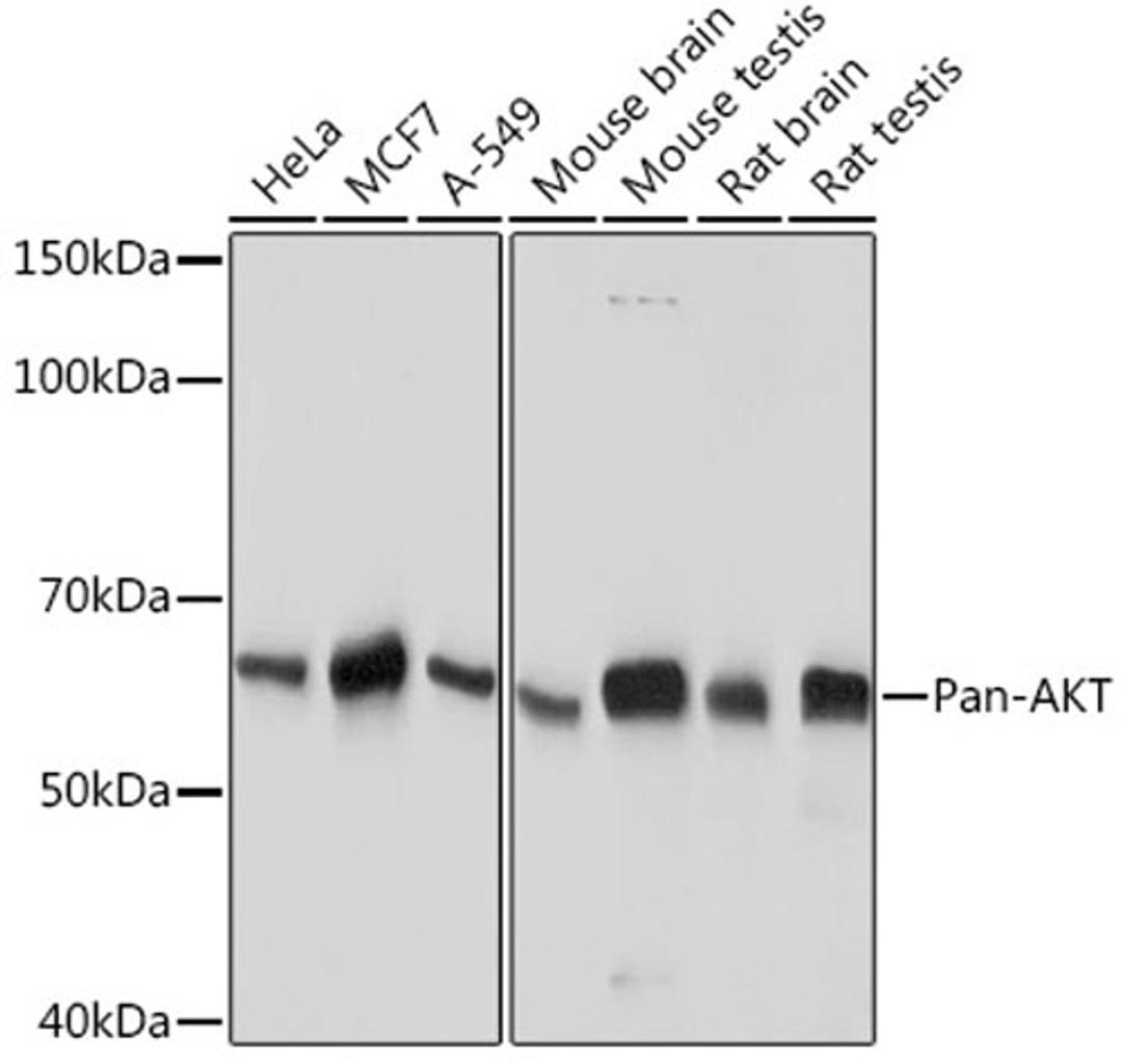 Western blot - Pan-AKT  antibody (A18675)