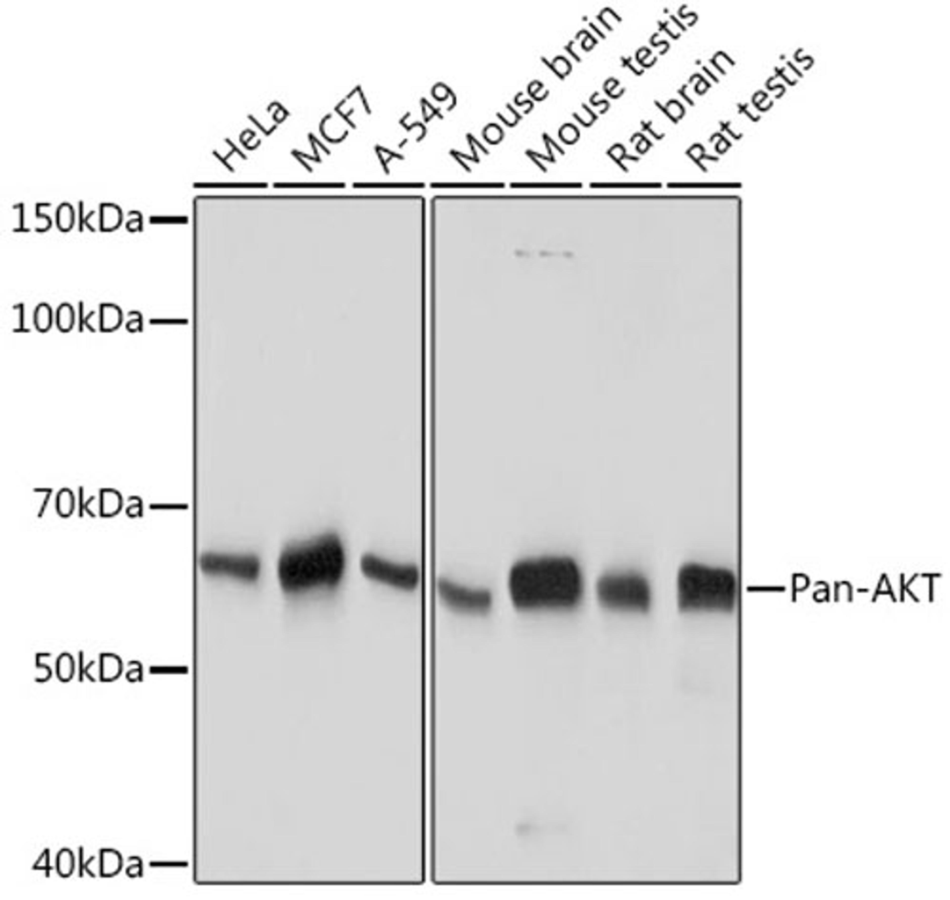 Western blot - Pan-AKT antibody (A18675)