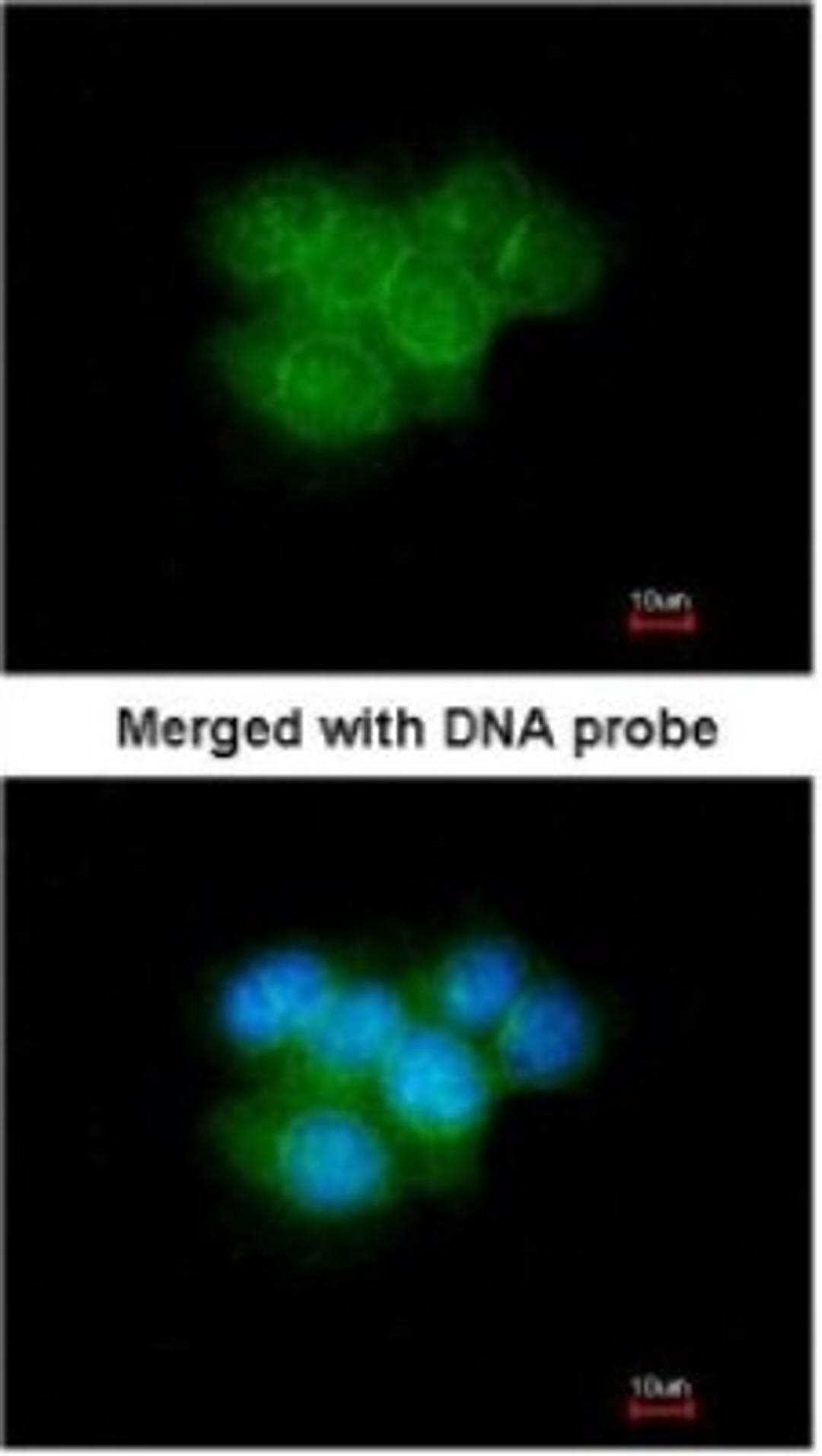 Immunocytochemistry/Immunofluorescence: Calretinin Antibody [NBP1-32244] - Paraformaldehyde-fixed A431, using antibody at 1:200 dilution.