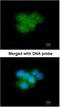 Immunocytochemistry/Immunofluorescence: Calretinin Antibody [NBP1-32244] - Paraformaldehyde-fixed A431, using antibody at 1:200 dilution.